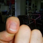 INDEX FINGER NAIL INDEX FINGER NAIL