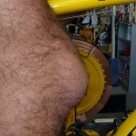 RIGHT KNEE RIGHT KNEE